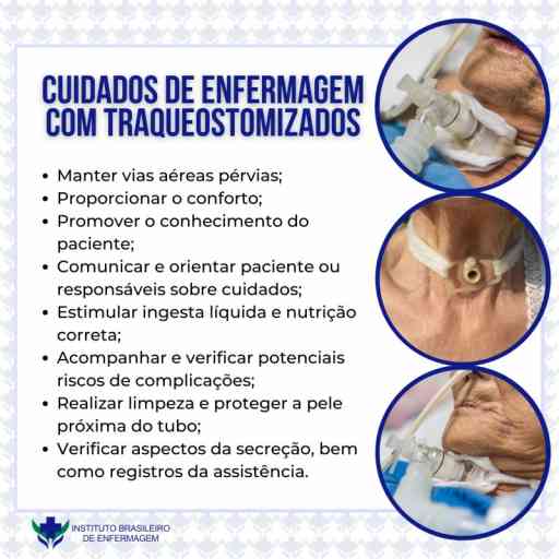 Importância da Enfermagem nos Cuidados de Traqueostomia Enfermagem 4You